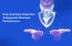How Anomaly Detection Safeguards Business Performance -Tatvic